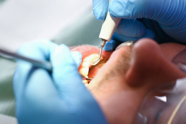 Best Emergency Treatment for Toothache in West Reading, PA